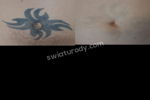 Łygan Salon Kosmetyki Laserowej